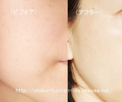 プラセンタエクストラクト 使用前使用後写真.jpg